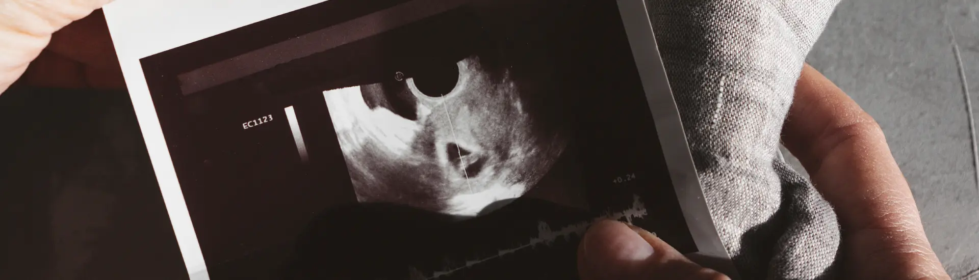 el-ultrasonido-obstetrico (2)