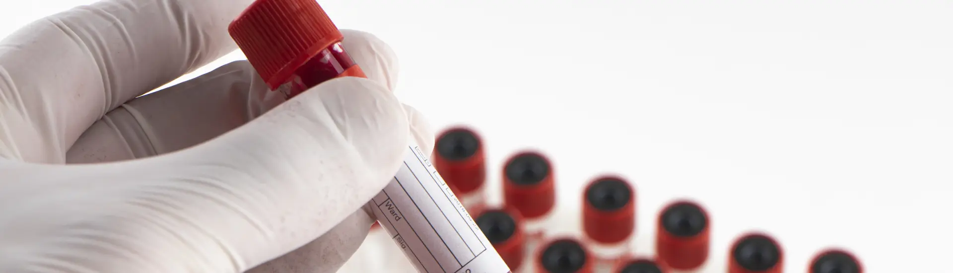 los-analisis-de-sangre-pueden